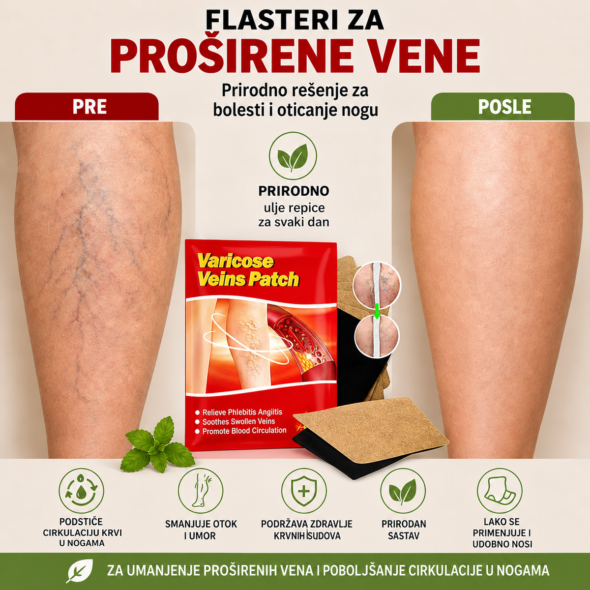Flasteri Za Proširene Vene – Zaboravite Na Bol i Otok! PROVERENO REŠAVA PROBLEM