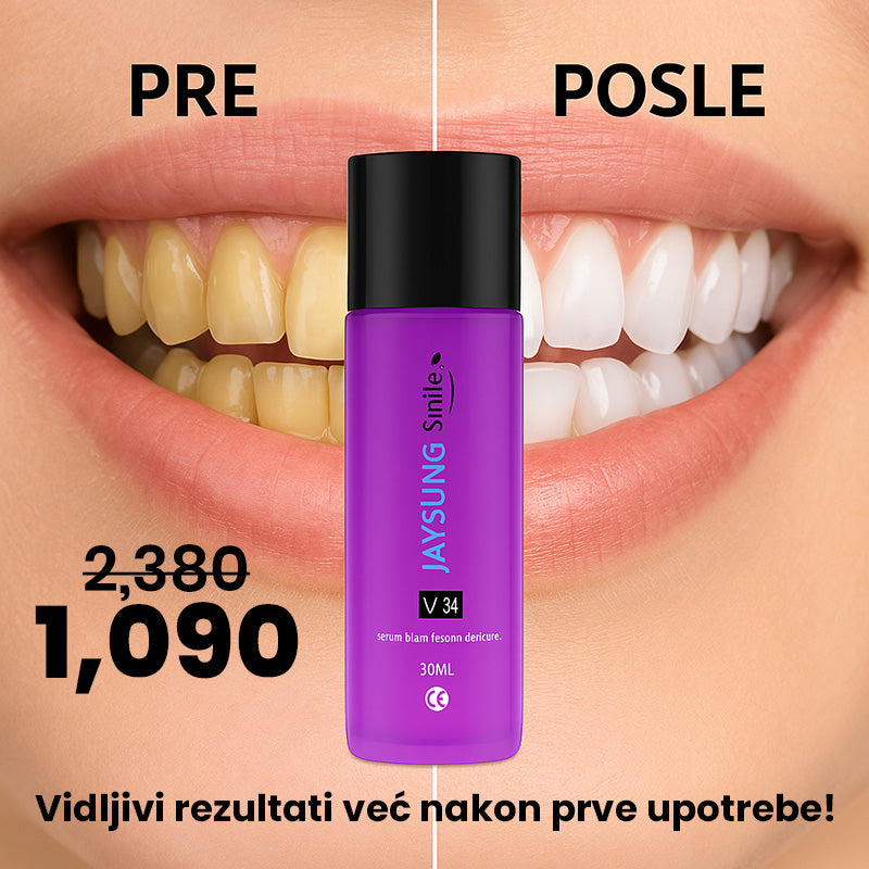 Zubi Kao Biseri – Bez Skupih Tretmana i Bola!