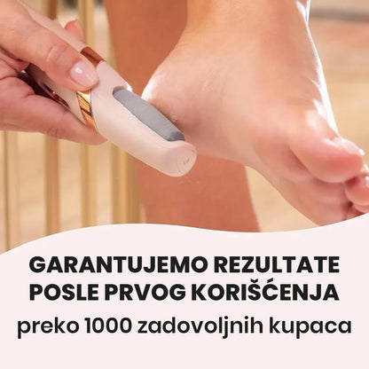 Mekane Pete U Trenu! Brzo, Efikasno i Bez Salona - Količina ograničena